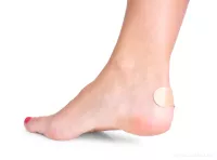 4 ks měkká pěnová náplast na patu/chodidla